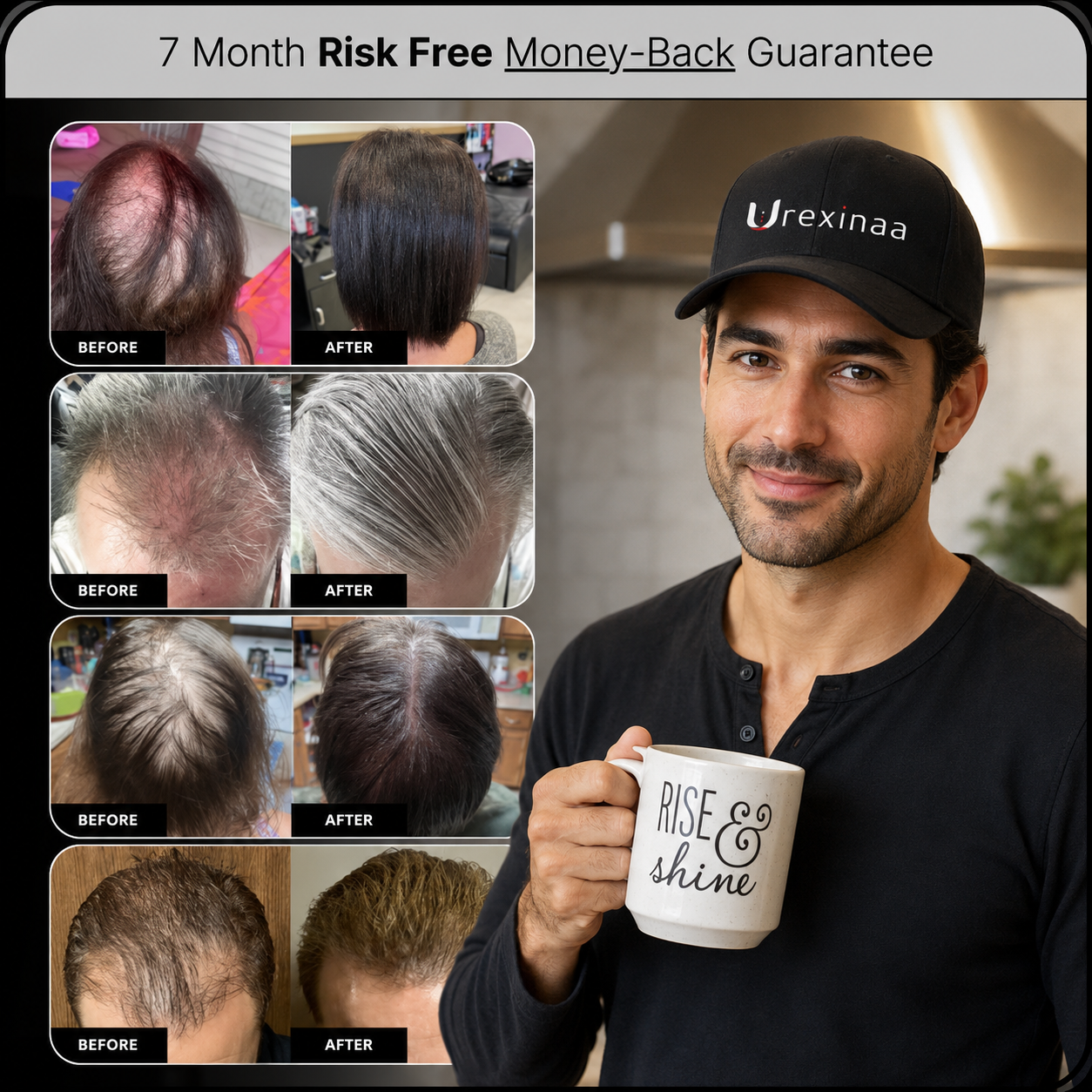 Urexinaa hair growth Cap