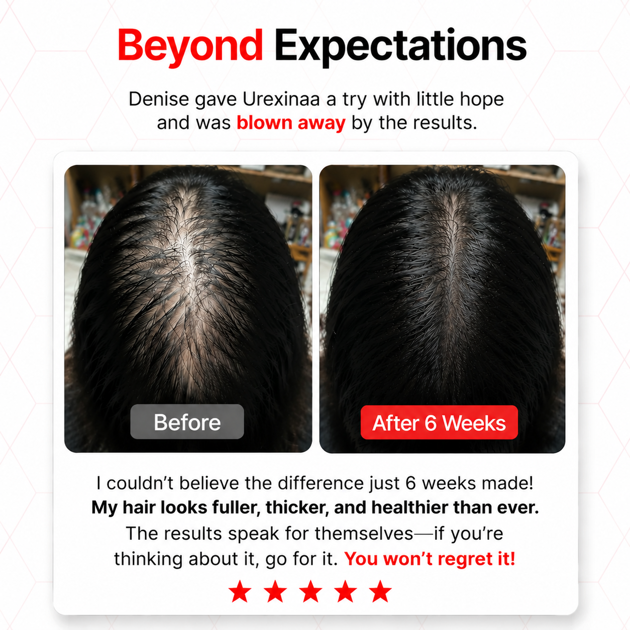 Urexinaa hair growth Cap